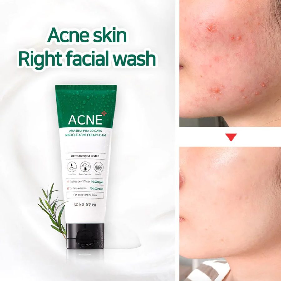 Some By Mi AHA BHA PHA 30 Days Miracle Foam