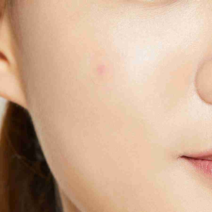 COSRX Acne Pimple Master