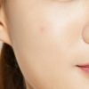 COSRX Acne Pimple Master