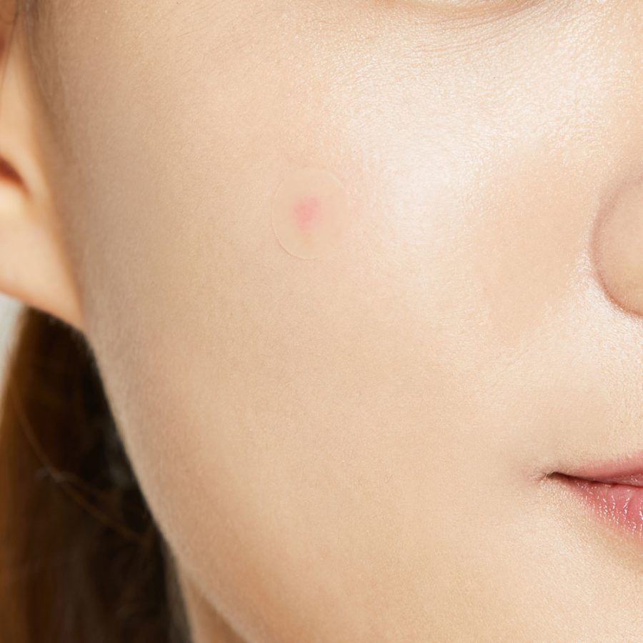 COSRX Acne Pimple Master